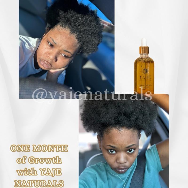 Double Growth – All-Natural Super Potent Hair Growth Oil | 13+ Herbs & 10 Oils | Fast Hair Regrowth & Bald Spot Treatment