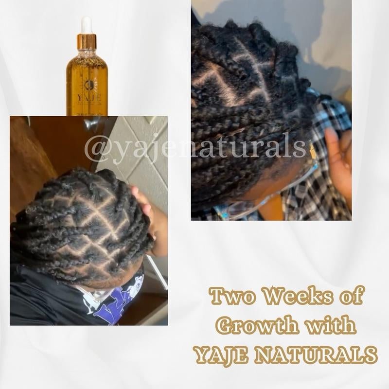 Double Growth – All-Natural Super Potent Hair Growth Oil | 13+ Herbs & 10 Oils | Fast Hair Regrowth & Bald Spot Treatment